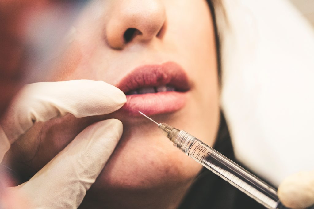 a woman has her lips injected with lip fillers by a professional with a glove on.
