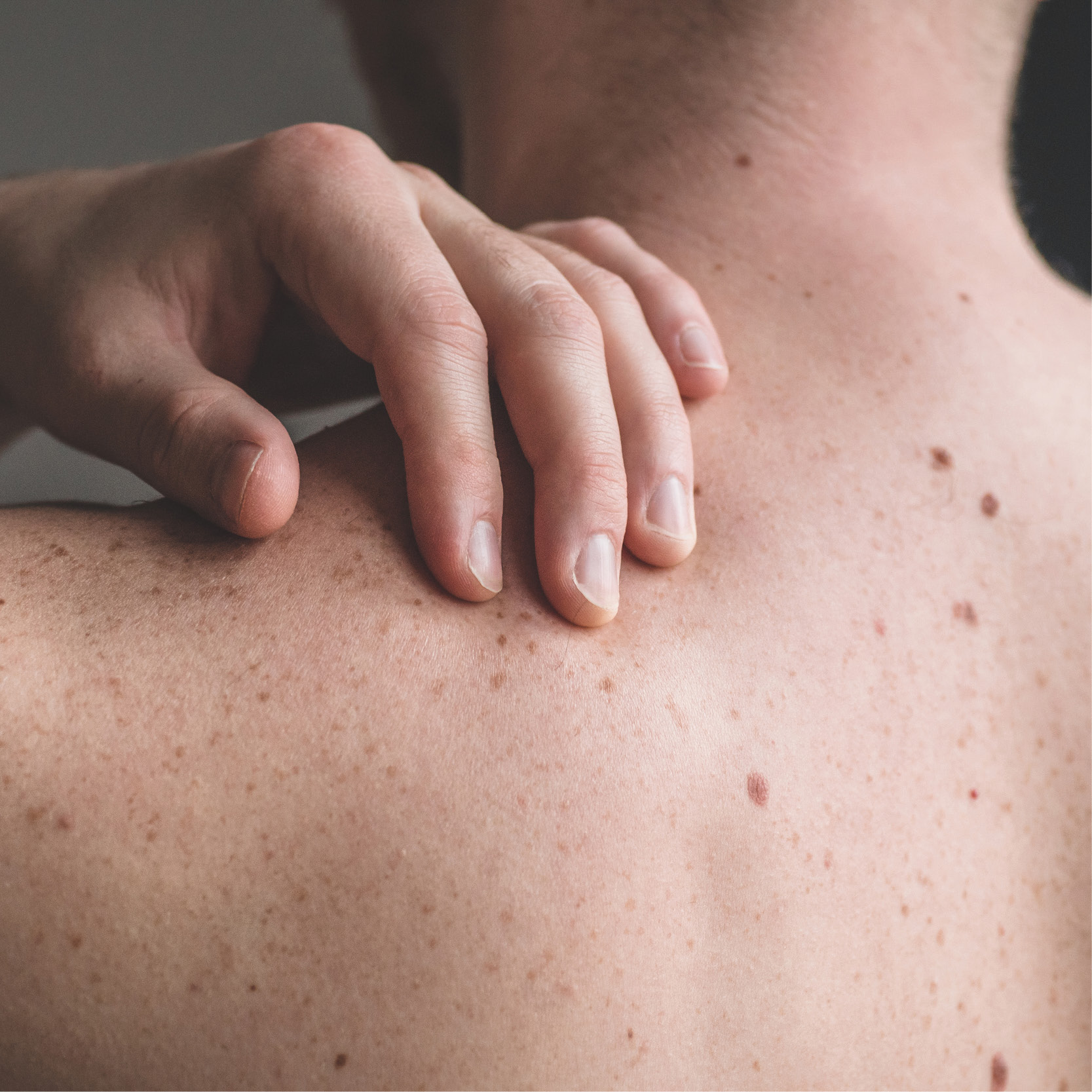 man checking his back for freckles