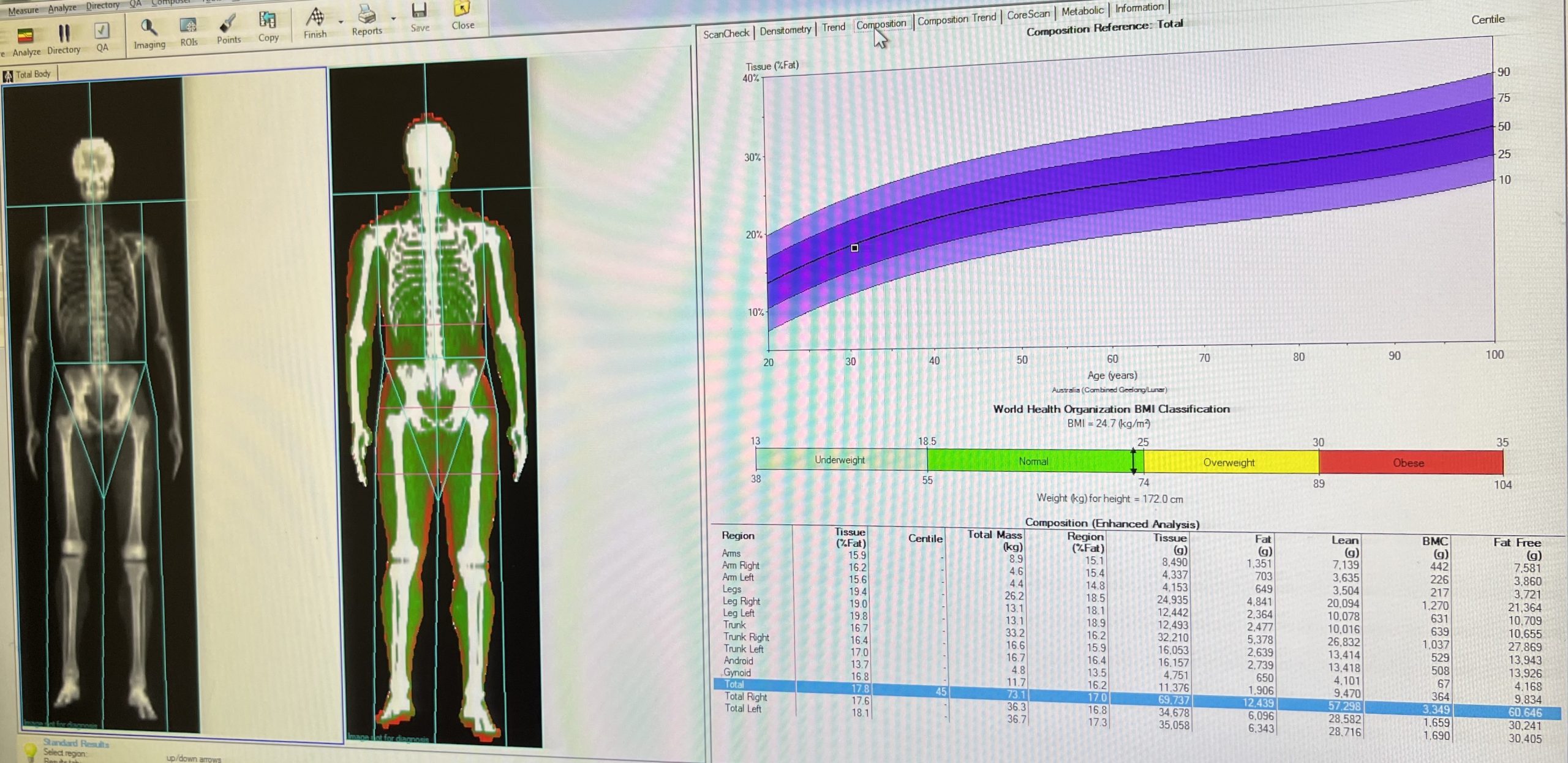 dexa scan body composition results