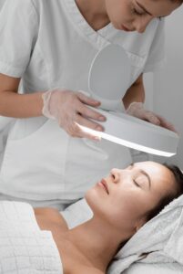 Laser treatment for acne scarring